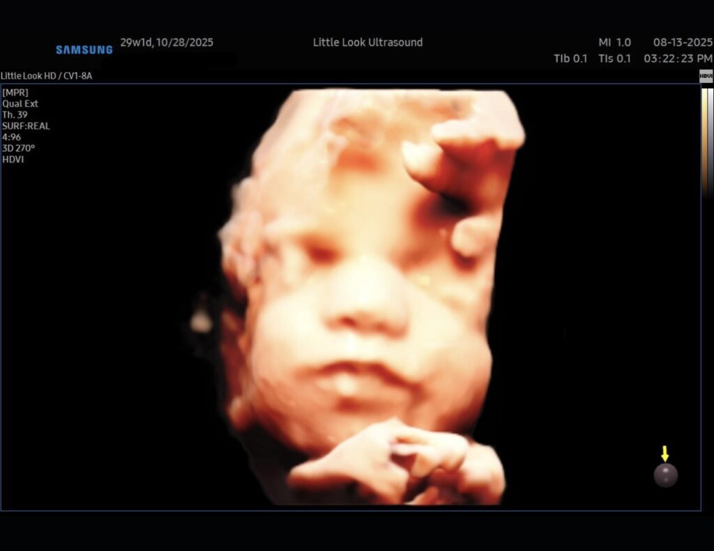 3D baby scan image of little one, located in londonderry nh near Windham nh and salem nh near ma border