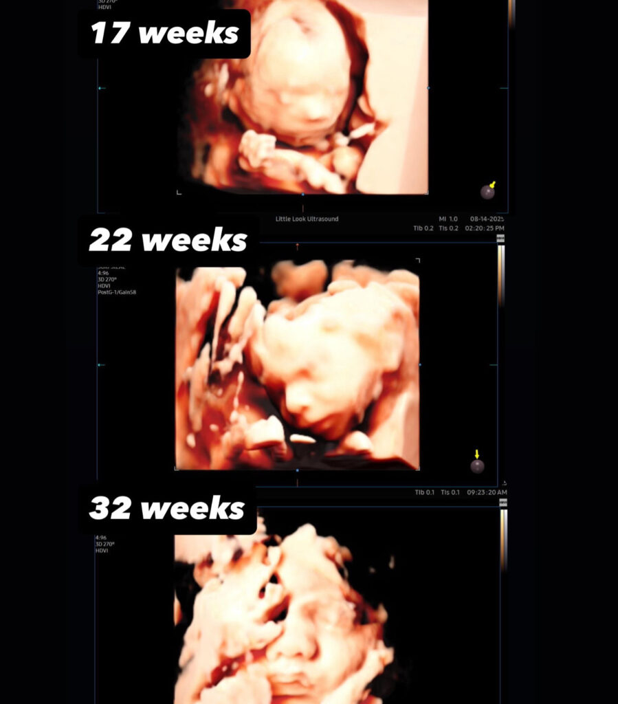 3d 4d baby ultrasound scans throughout different weeks of pregnancy in different views and stages