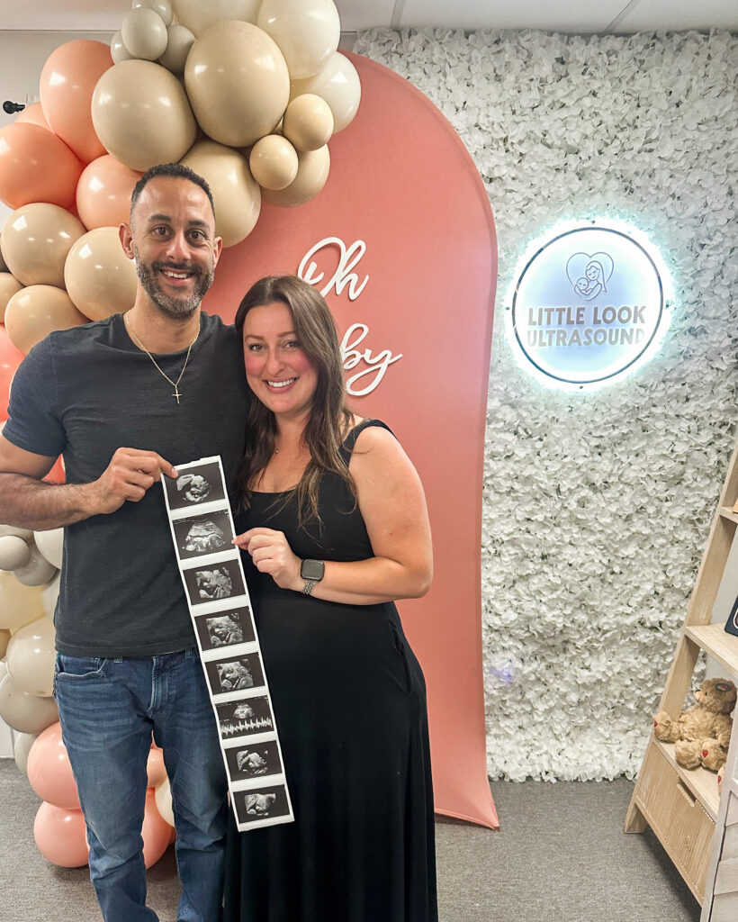 Couple , Pregnancy , 3d 4d ,ultrasound , sonogram , prints , photos , baby , southern nh moms , massachusetts , ultrasound near me , baby , prenatal , 3d ultrasound New Hampshire 