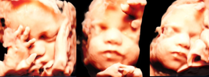 babies in 3d 4d hd elective ultrasounds at Little Look private studio located in Londonderry nh next to Derry NH Windham NH and Salem NH near Boston MA