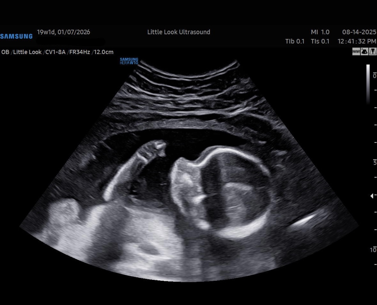 baby scan 2d elective ultrasound gender chelmsford ma Merrimack nh Bedford nh medford ma Hudson Manchester Lowell Boston nashua ultrasound near me