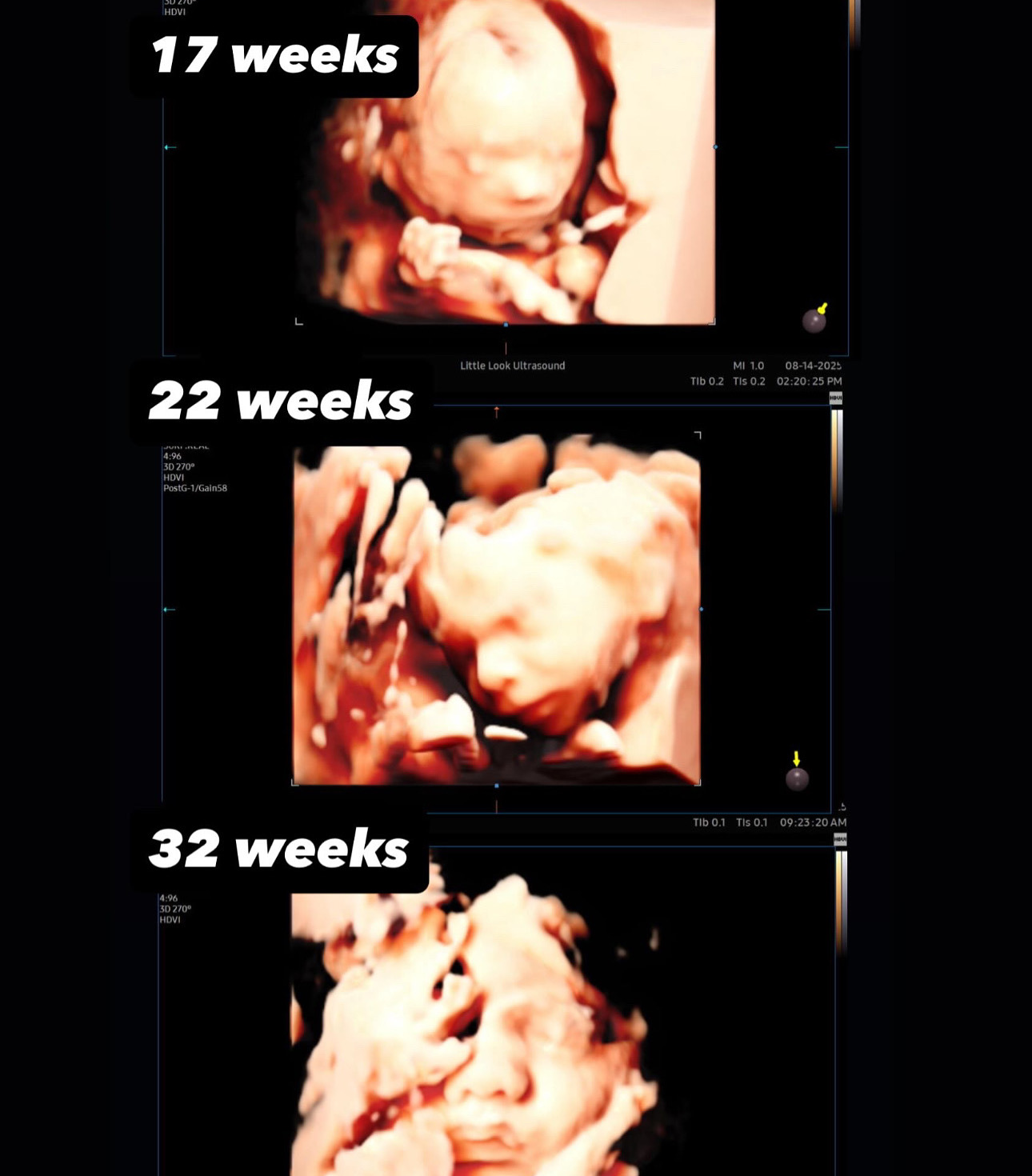 3d 4d baby ultrasound scans throughout different weeks of pregnancy in different views and stages