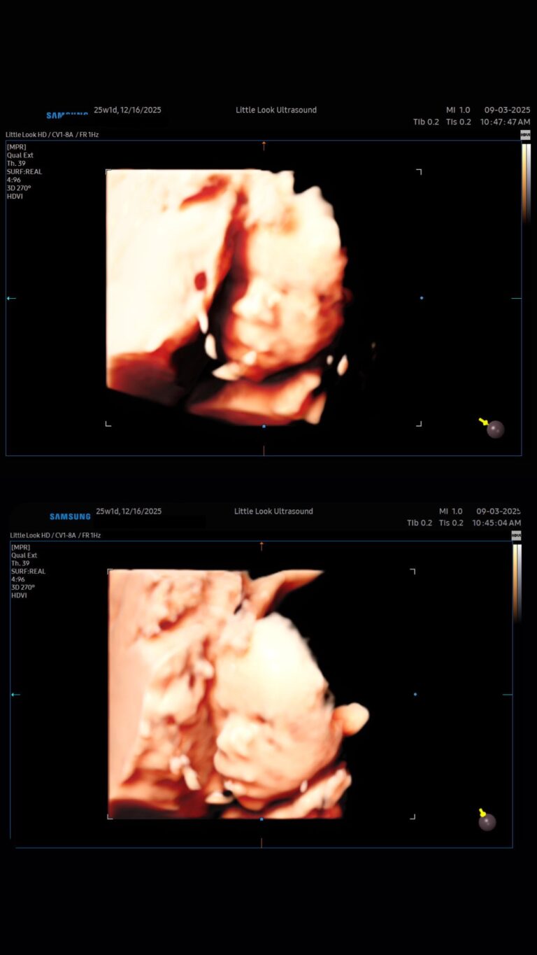 3d baby scan in New Hampshire elective ultrasound studio boutique, 4d ultrasound technology and video in southern New Hampshire near massachusetts