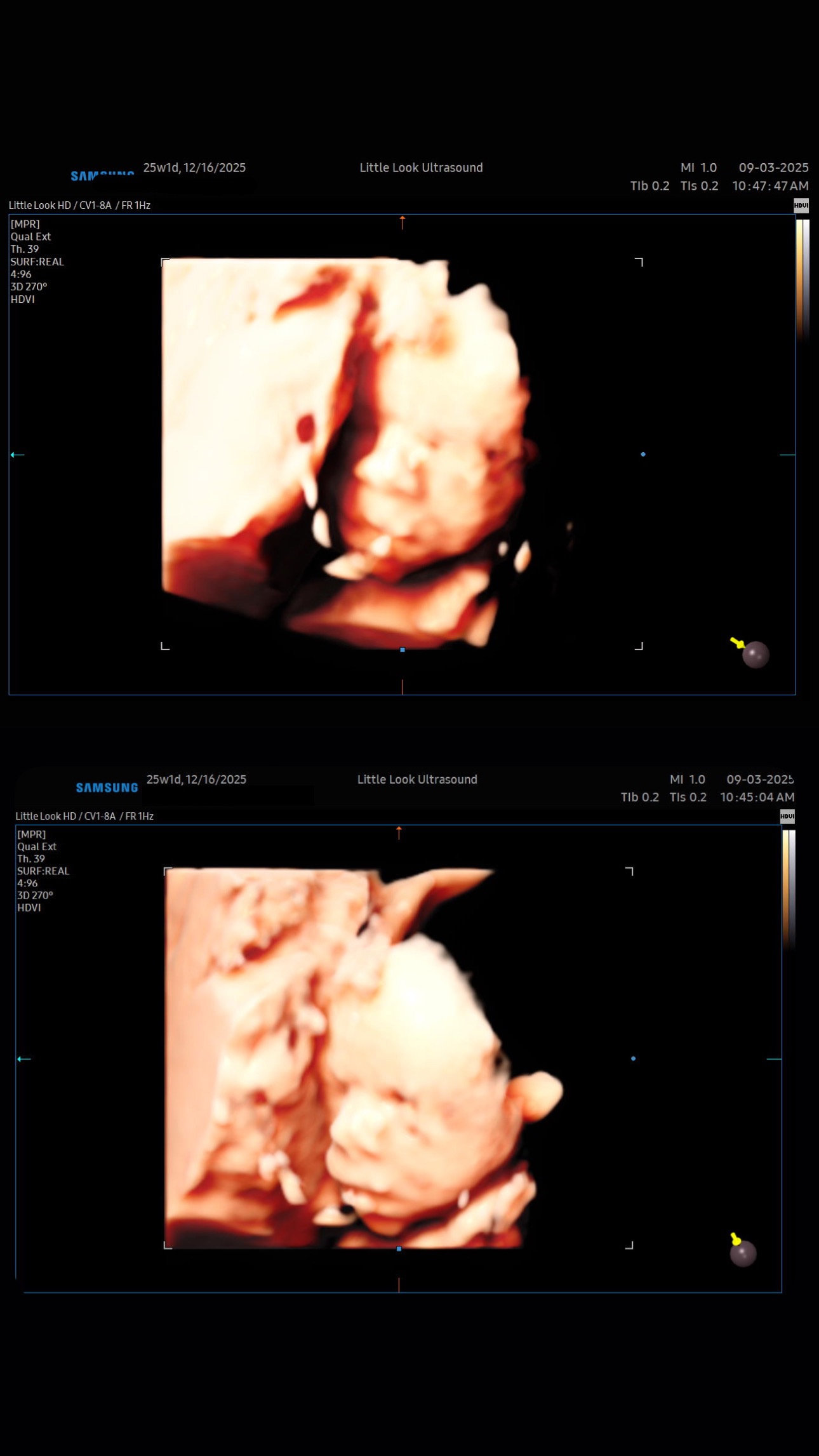 3d baby scan in New Hampshire elective ultrasound studio boutique, 4d ultrasound technology and video in southern New Hampshire near massachusetts