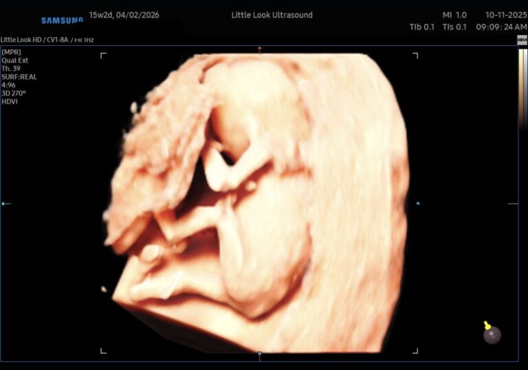 15 week pregnant 16 week fetus in pregnancy 3d ultrasound 4d sonogram