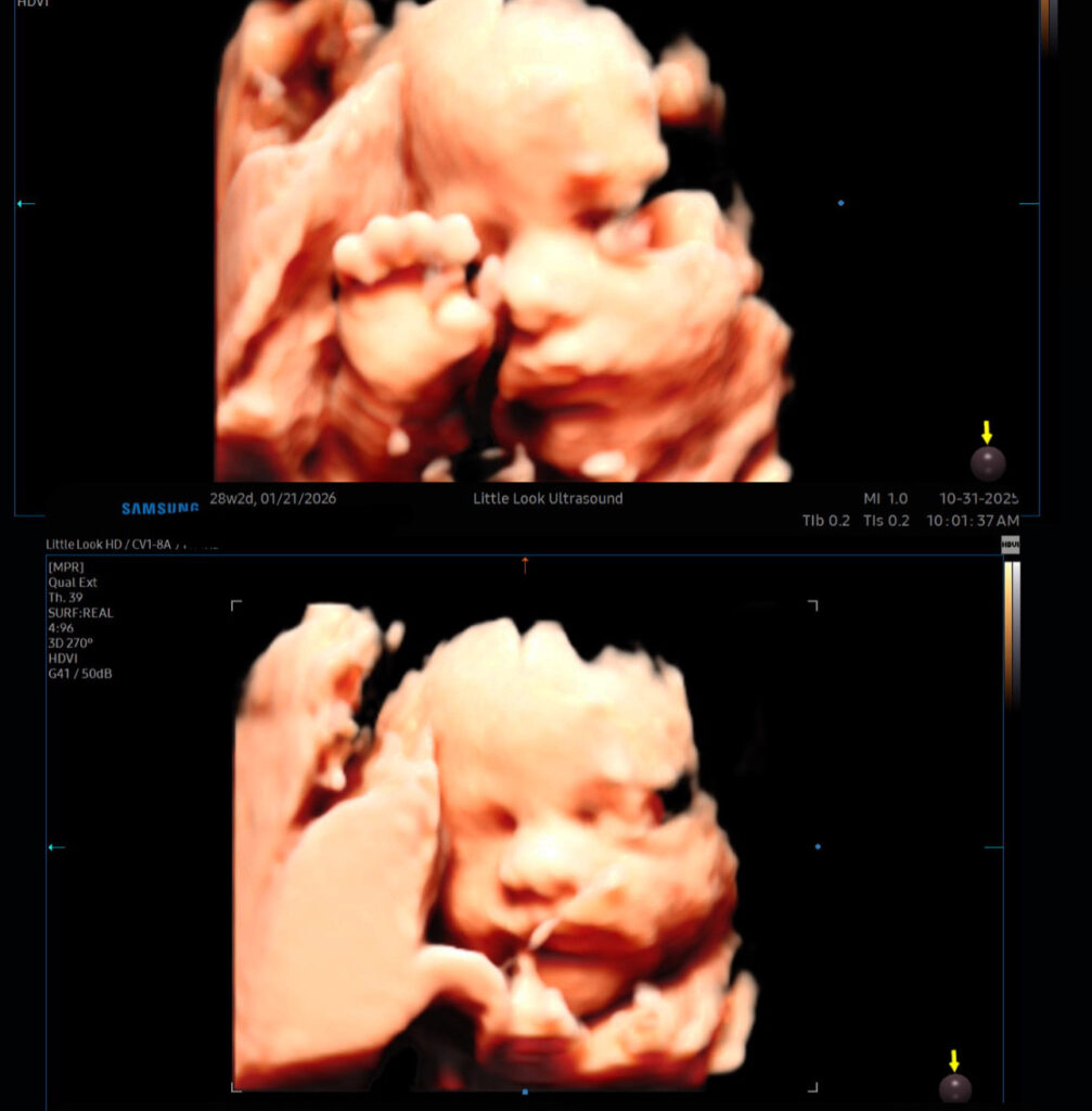 baby imaging sonogram at 3d 4d ultrasound studio boutique in southern nh near ma appointment for Christmas holiday season
