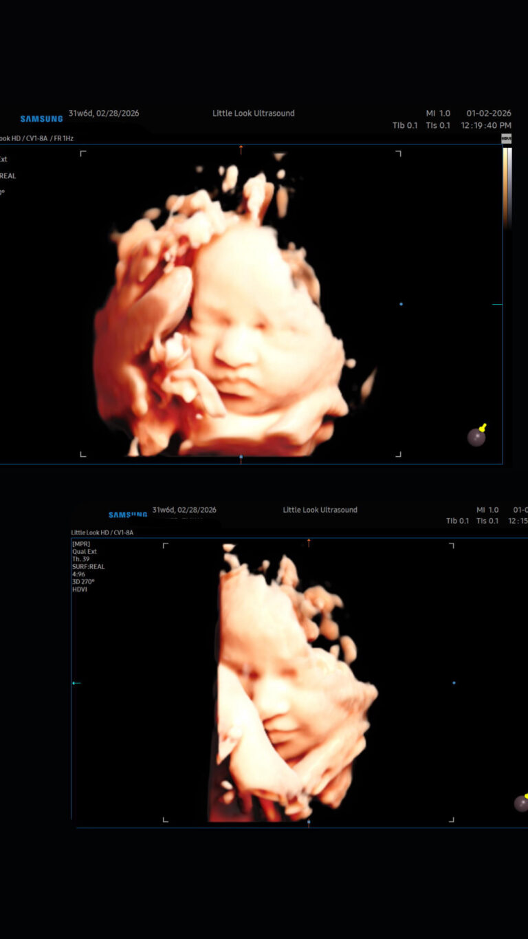 3d 4d private ultrasound sonogram third trimester baby scan imaging