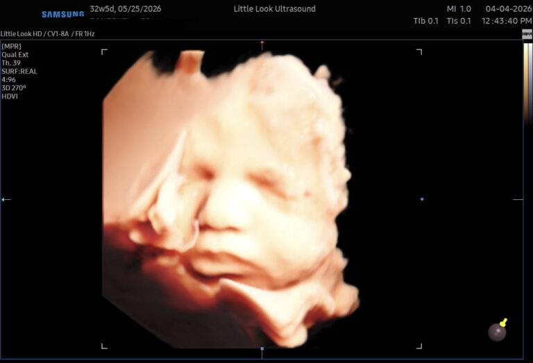 Gift a 3D Ultrasound this Mother’s Day!