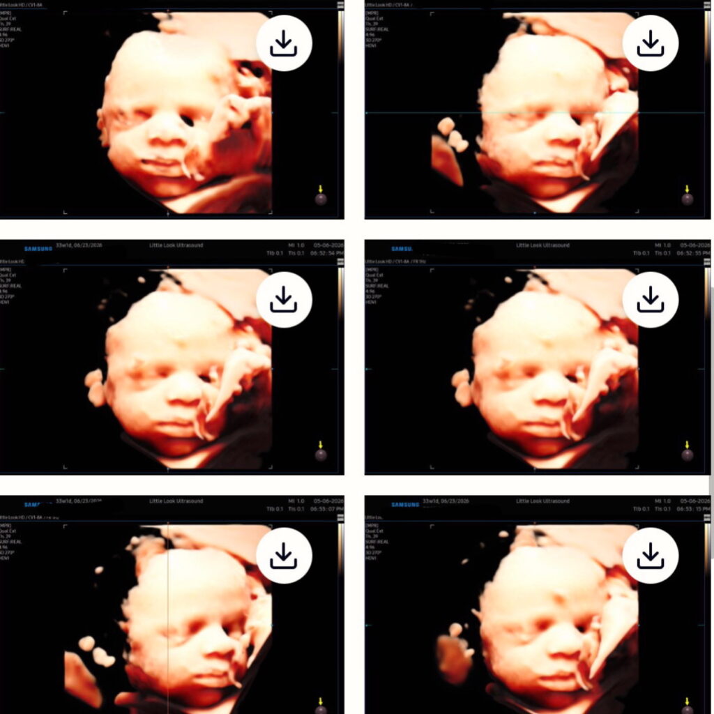 baby 3d ultrasound of 33 week old fetus in womb of pregnant mom in southern nh ma