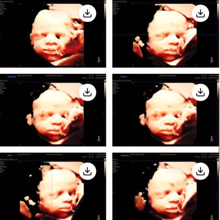 Your Baby’s First Photos: when to book a 3D ultrasound near me